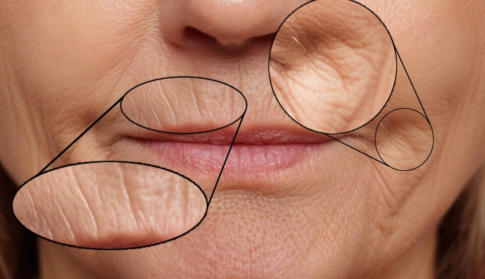 Close-up of wrinkles around the mouth